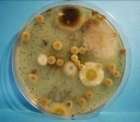 Отравления, вызываемые микроскопическими грибами. Микотоксикозы